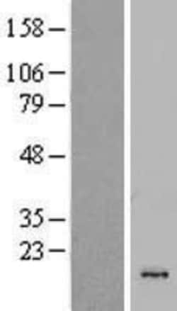 Novus Biologicals™ CSTL1 Overexpression Lysate