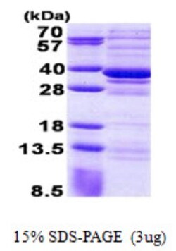 Novus Biologicals&trade;&nbsp;Recombinant Human CSTP1 His Protein
