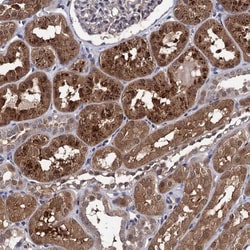 CSTP1 Antibody, Novus Biologicals:Antibodies:Primary Antibodies