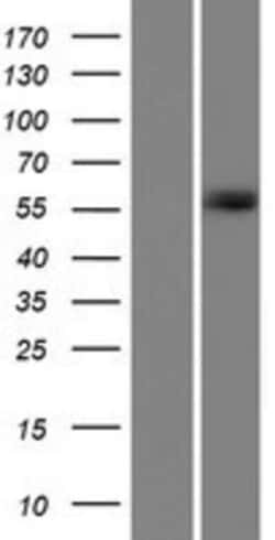 Novus Biologicals&trade;&nbsp;CT110 Overexpression Lysate