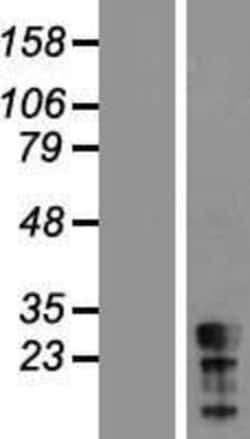 Novus Biologicals&trade;&nbsp;CT45A5 Overexpression Lysate