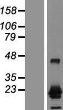 Novus Biologicals™ CTAG1A Overexpression Lysate