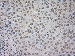 CTAG1B Antibody (OTI2B6), Novus Biologicals 0.1mL; Unlabeled:Antibodies,