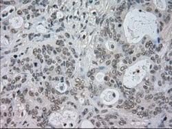 CTAG1B Antibody (OTI2B6), Novus Biologicals 0.1mL; Unlabeled:Antibodies,
