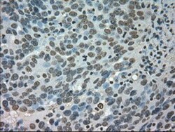 CTAG1B Antibody (OTI2B6), Novus Biologicals 0.1mL; Unlabeled:Antibodies,
