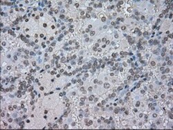 CTAG1B Antibody (OTI2B6), Novus Biologicals 0.1mL; Unlabeled:Antibodies,