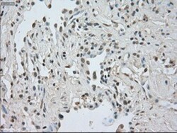 CTAG1B Antibody (OTI2B6), Novus Biologicals 0.1mL; Unlabeled:Antibodies,
