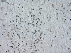CTAG1B Antibody (OTI2B6), Novus Biologicals 0.1mL; Unlabeled:Antibodies,