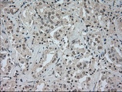 CTAG1B Antibody (OTI2B6), Novus Biologicals 0.1mL; Unlabeled:Antibodies,