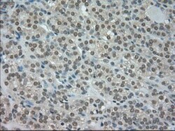 CTAG1B Antibody (OTI2B6), Novus Biologicals 0.1mL; Unlabeled:Antibodies,