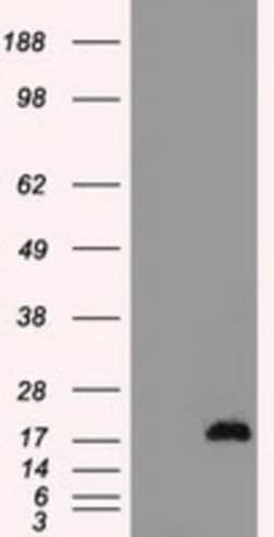 CTAG1B Antibody (OTI2B6), Novus Biologicals 0.1mL; Unlabeled:Antibodies,