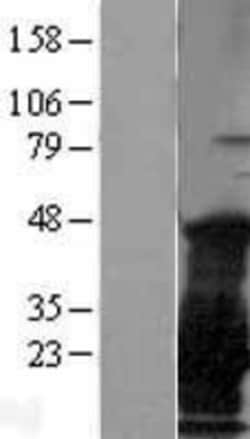 Novus Biologicals&trade;&nbsp;CTAG1B Overexpression Lysate