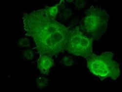 CTAG1B Antibody (OTI2B6), Novus Biologicals 0.1mL; Unlabeled:Antibodies,