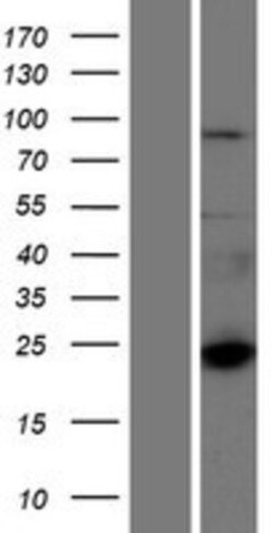 Novus Biologicals&trade;&nbsp;CTAGE6 Overexpression Lysate