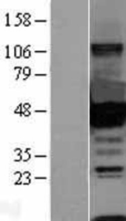 Novus Biologicals&trade;&nbsp;CtBP1 Overexpression Lysate