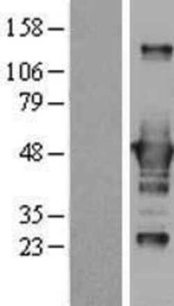 Novus Biologicals&trade;&nbsp;CtBP1 Overexpression Lysate