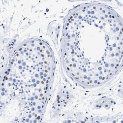 CtBP1 Antibody, Novus Biologicals 0.1mL; Unlabeled:Antibodies, Polyclonal