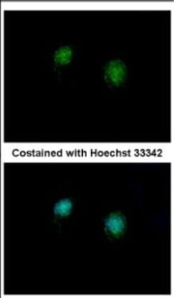 CTBP2 Antibody, Novus Biologicals 0.1mL; Unlabeled:Antibodies, Polyclonal
