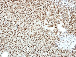 CTBP2 Antibody, Novus Biologicals 0.1mL; Unlabeled:Antibodies, Polyclonal