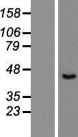 Novus Biologicals™ Chitobiase/CTBS Overexpression Lysate