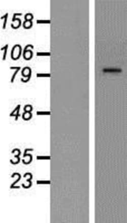 Novus Biologicals&trade;&nbsp;CTCF Overexpression Lysate