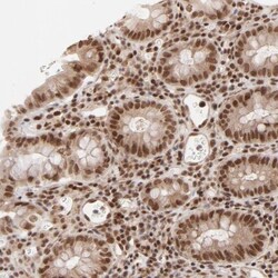 CTCF Antibody, Novus Biologicals 0.1mL; Unlabeled:Antibodies, Polyclonal