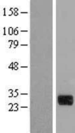 Novus Biologicals&trade;&nbsp;CTDSP1 Overexpression Lysate