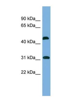 CTDSP2 Antibody, Novus Biologicals 100 &mu;L | Buy Online | Novus Biologicals | Fisher Scientific