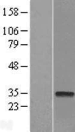 Novus Biologicals&trade;&nbsp;CTDSP2 Overexpression Lysate