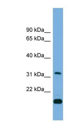 CTDSP2 Antibody, Novus Biologicals 100 &mu;L | Buy Online | Novus Biologicals | Fisher Scientific