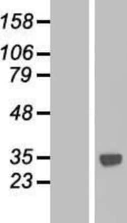 Novus Biologicals&trade;&nbsp;CTDSPL Overexpression Lysate
