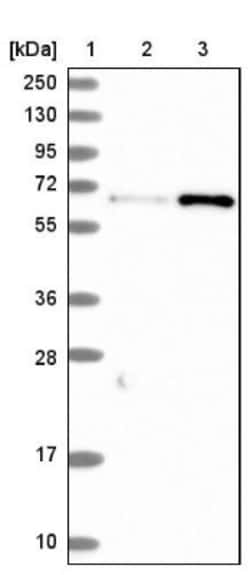 CTDSPL2 Antibody, Novus Biologicals 0.1mL; Unlabeled:Antibodies, Polyclonal