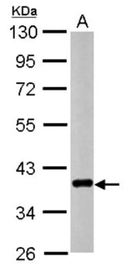 CTGF/CCN2 Antibody, Novus Biologicals 0.1mL; Unlabeled:Antibodies, Polyclonal