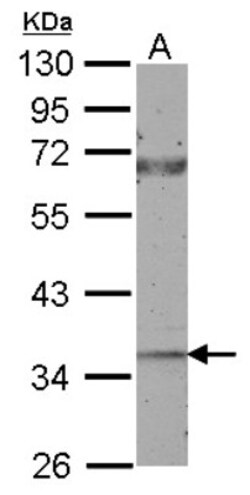 CTGF/CCN2 Antibody, Novus Biologicals 0.1mL; Unlabeled:Antibodies, Polyclonal