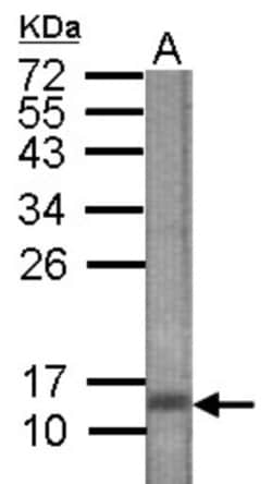 CTGF/CCN2 Antibody, Novus Biologicals 0.1mL; Unlabeled:Antibodies, Polyclonal