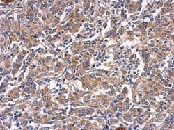 CTGF/CCN2 Antibody, Novus Biologicals 0.1mL; Unlabeled:Antibodies, Polyclonal