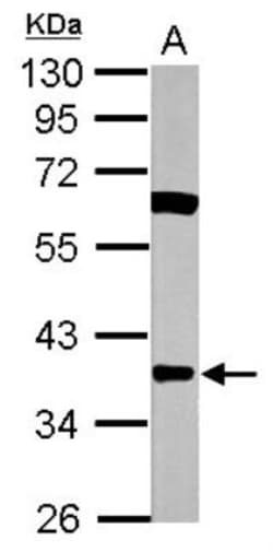 CTGF/CCN2 Antibody, Novus Biologicals 0.1mL; Unlabeled:Antibodies, Polyclonal