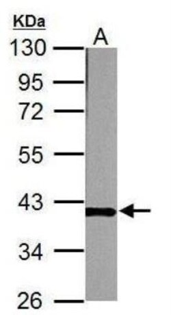 CTGF/CCN2 Antibody, Novus Biologicals 0.1mL; Unlabeled:Antibodies, Polyclonal