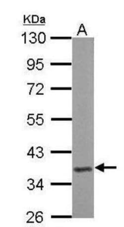 CTGF/CCN2 Antibody, Novus Biologicals 0.1mL; Unlabeled:Antibodies, Polyclonal