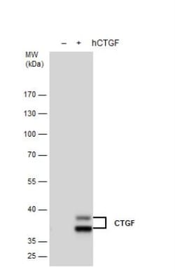 CTGF/CCN2 Antibody, Novus Biologicals 0.1mL; Unlabeled:Antibodies, Polyclonal