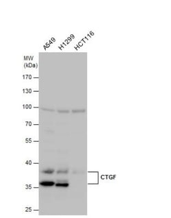 CTGF/CCN2 Antibody, Novus Biologicals 0.1mL; Unlabeled:Antibodies, Polyclonal