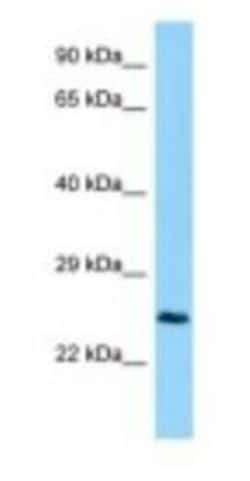 CTHRC1 Antibody, Novus Biologicals:Antibodies:Primary Antibodies