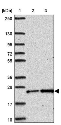 CTHRC1 Antibody, Novus Biologicals 0.1mL; Unlabeled:Antibodies, Polyclonal
