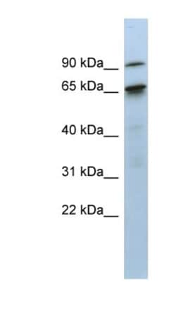 CTIF Antibody, Novus Biologicals 100&mu;L; Unlabeled:Antibodies, Polyclonal