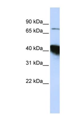 CTIF Antibody, Novus Biologicals:Antibodies:Primary Antibodies