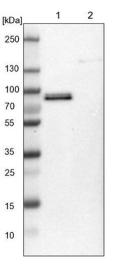 CTIF Antibody, Novus Biologicals:Antibodies:Primary Antibodies