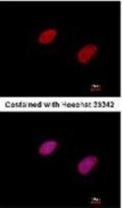 CtIP Antibody (19E8), Novus Biologicals 0.1mg; Unlabeled:Antibodies, Monoclonal