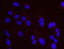 CtIP Antibody, Novus Biologicals 0.1mL; Unlabeled:Antibodies, Polyclonal
