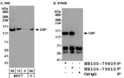 CtIP Antibody, Novus Biologicals 0.1mL; Unlabeled:Antibodies, Polyclonal