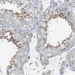 CTL5 Antibody, Novus Biologicals 25 &mu;L | Buy Online | Novus Biologicals | Fisher Scientific